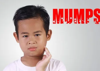 know about how to treat mumps in children