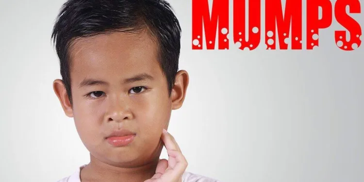 know about how to treat mumps in children