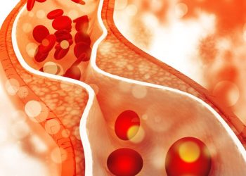 COVID-19 Can Cause New Cholesterol Problems