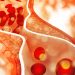 COVID-19 Can Cause New Cholesterol Problems