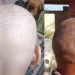 wheat not responsible for hair loss buldhana