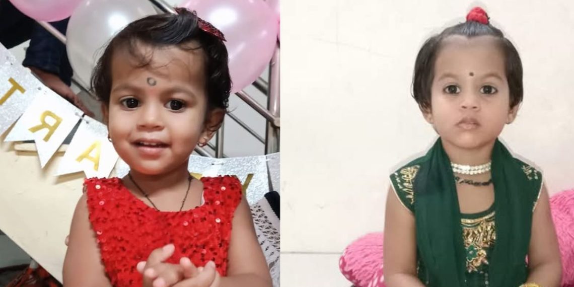four years girl injured as fell in boiled water loni kalbhor Pune