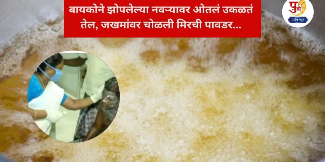 Delhi Crime: 'If you scream...' Wife pours boiling oil on sleeping husband, rubs chilli powder on wounds...