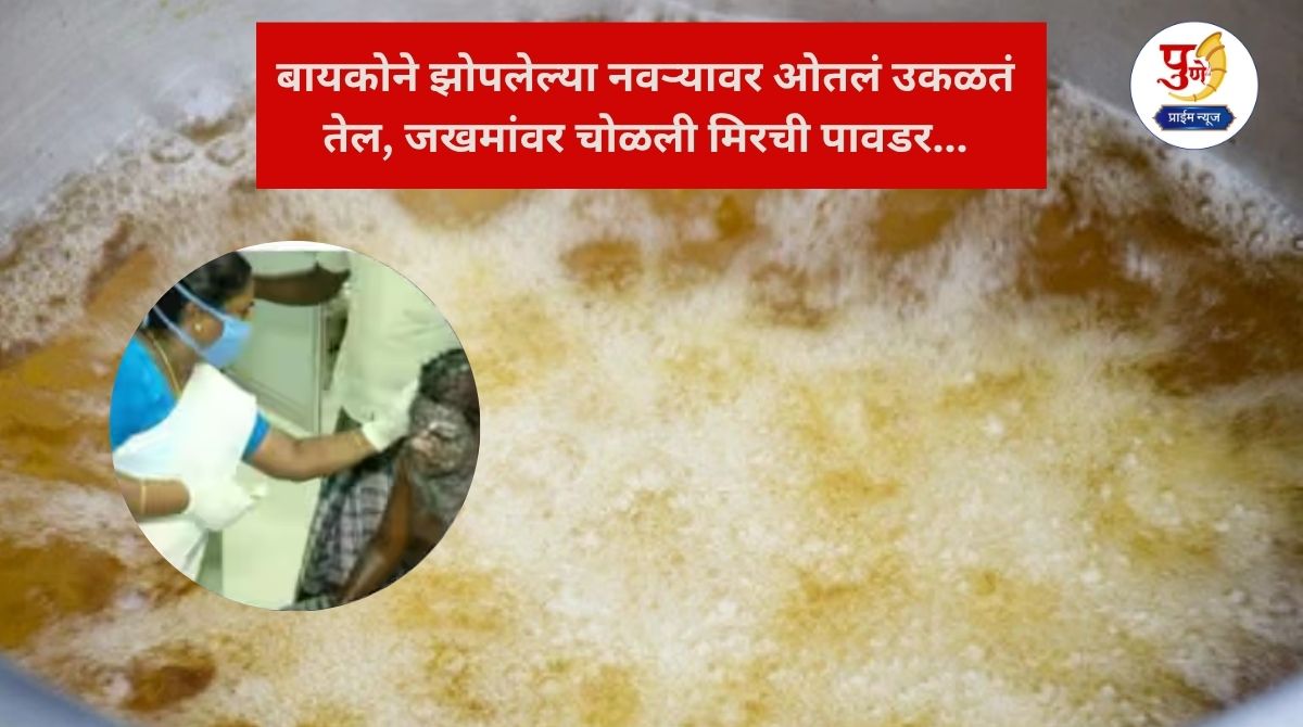Delhi Crime: 'If you scream...' Wife pours boiling oil on sleeping husband, rubs chilli powder on wounds...