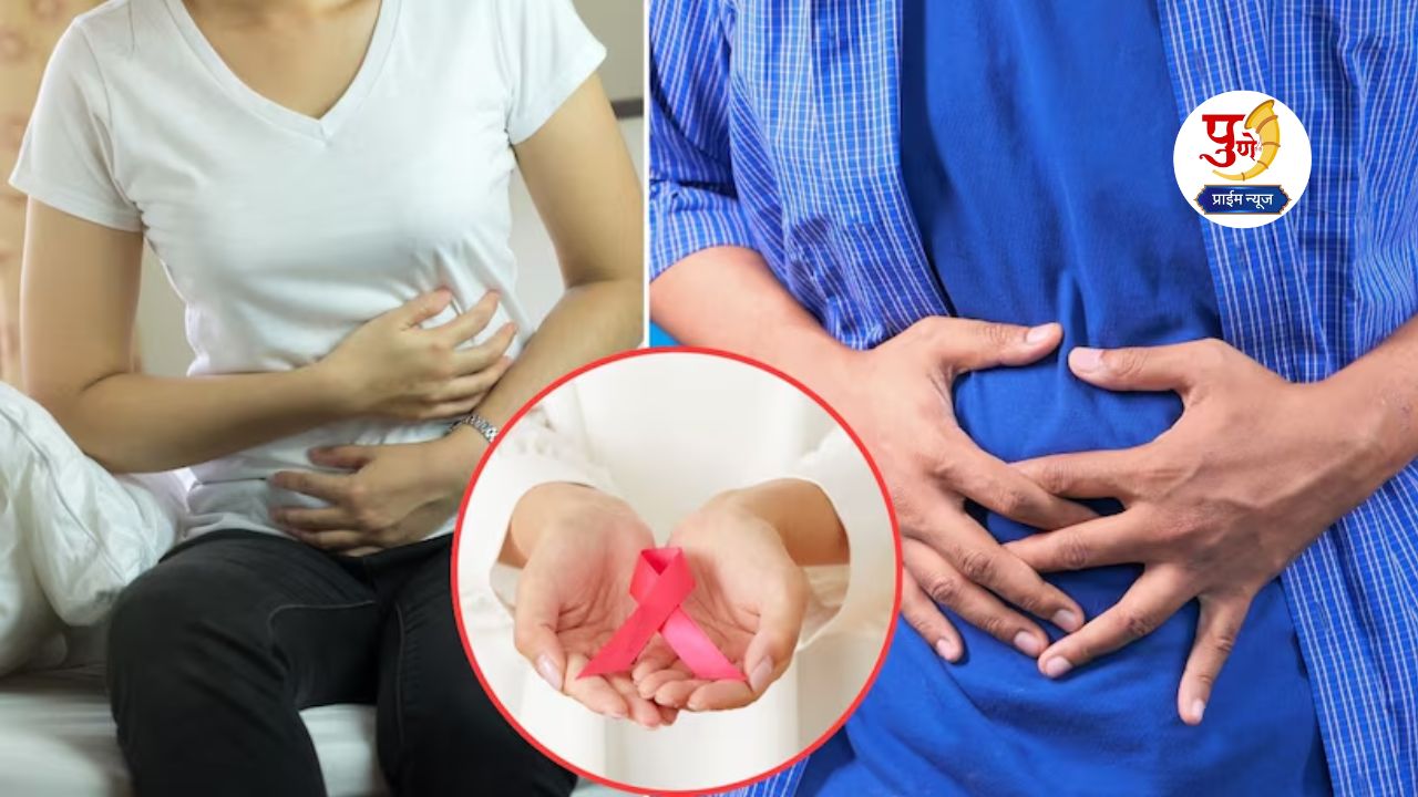 Colon Cancer Symptoms